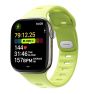 Nomad Tempo Armband Apple Watch 38mm/ 40mm/ 41mm/ 42mm Limettengrün sticky